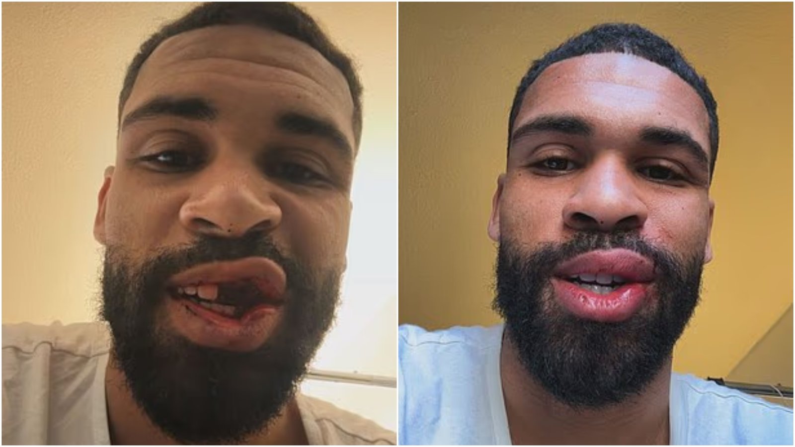 Loftus-Cheek după accidentarea din meciul Parma - AC Milan